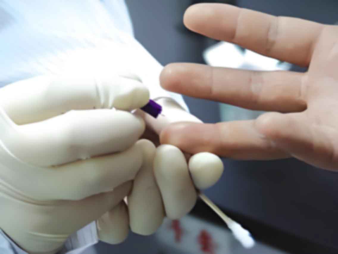 湛江赤坎区移民亲子鉴定需要什么材料